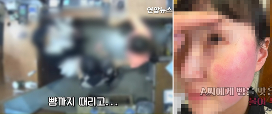 A screen capture of CCTV footage, left, shows the altercation between the wife of Belgian Ambassador to Korea Peter Lescouhier and two employees at a clothing store in Yongsan District, central Seoul, on April 9. The manager of the store, right, shows her cheek after she was slapped by the wife. [YONHAP]