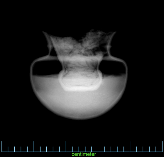 An x-ray of the discovered pottery shows a smaller pot inside the larger one [CULTURAL HERITAGE ADMINISTRATION]
