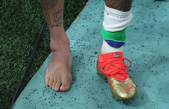 Picture of the swollen ankle of Brazil's forward Neymar taken as he leaves the field at the end of the Qatar 2022 World Cup Group G football match between Brazil and Serbia at the Lusail Stadium in Lusail, north of Doha on Thursday. [AFP/YONHAP]