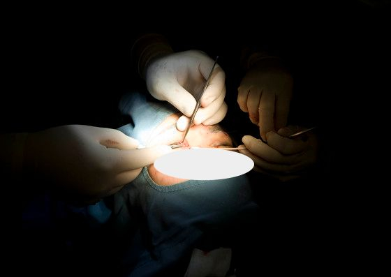 A patient receives double-eyelid surgery at a hospital in Seoul on Sept. 10, 2020. [JOONGANG PHOTO]