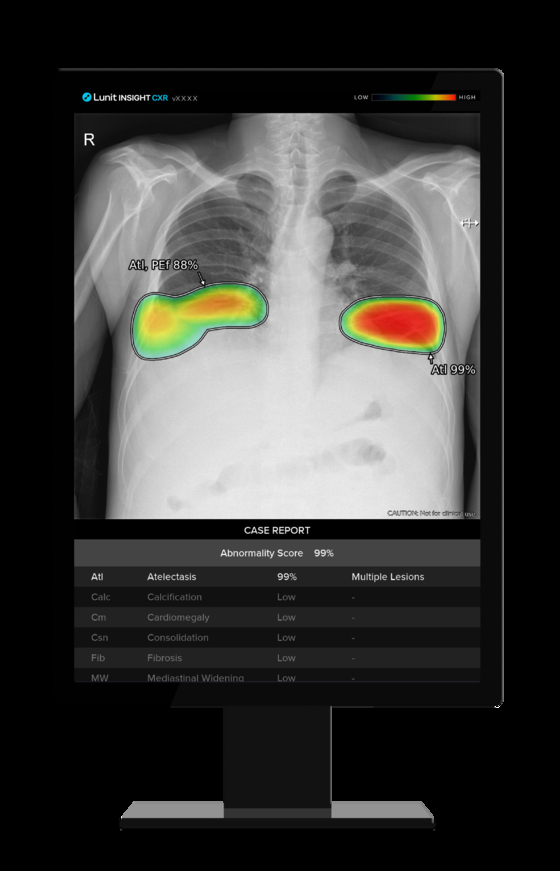 Screen image of Lunit's AI-powered chest screening software, Lunit Insight CXR [LUNIT]