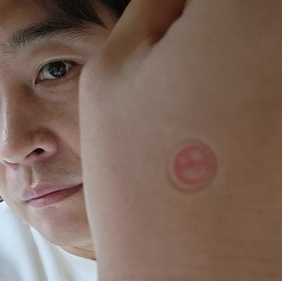 Footballer Lee Dong-gook showed off his hand marked with the voting stamp in an Instagram post that read "Exercise your right to vote." He added the Korean hashtags "Back of my hand is fat" and "So bloated." [SCREEN CAPTURE]