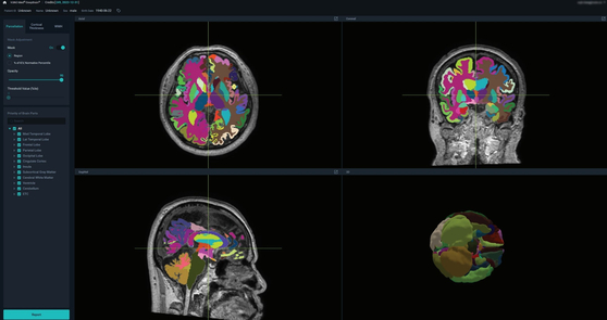 Medical imaging of VUNO Med-DeepBrain [VUNO]