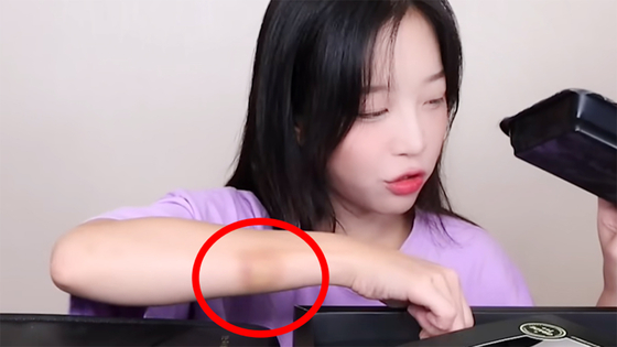A captured image of Tzuyang with bruises in her past videos [SCREEN CAPTURE]