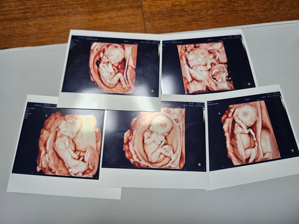 Sonograms of quintuplets born last Friday in Seoul [SEOUL ST.MARY'S HOSPITAL] 